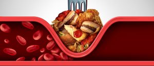 Egészséges ételek és orvosi laborlelet sztetoszkóppal az asztalon, illusztrálva a vérzsírok és az étrend kapcsolatát.