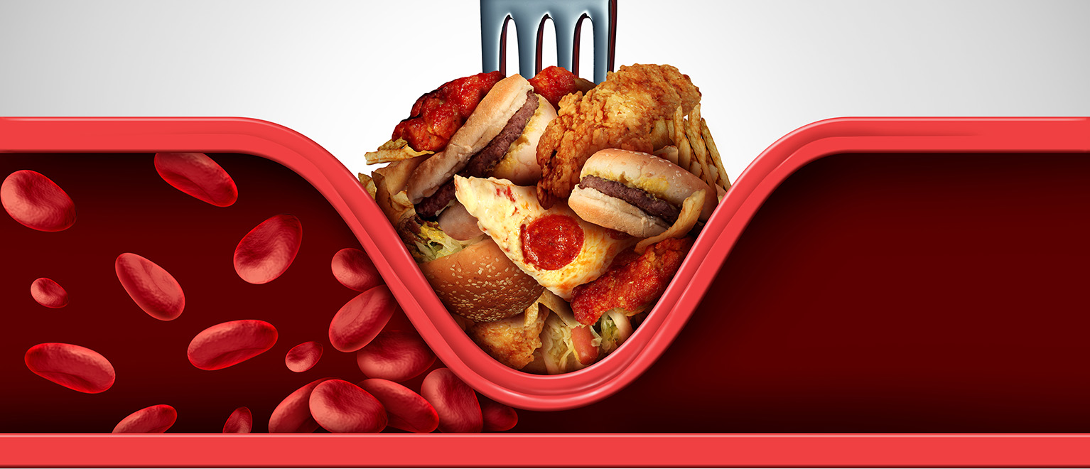 Egészséges ételek és orvosi laborlelet sztetoszkóppal az asztalon, illusztrálva a vérzsírok és az étrend kapcsolatát.