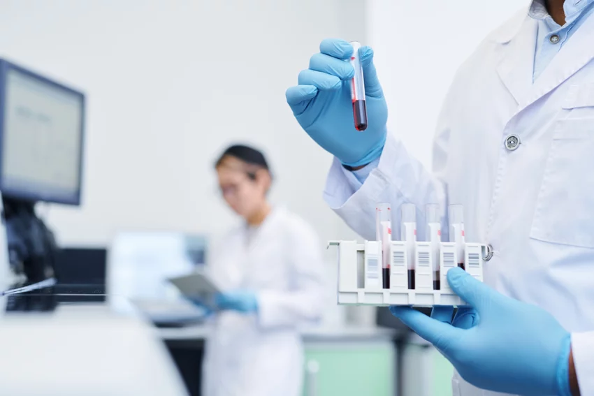 Teljes vérkép vizsgálat laborban, mikroszkóp alatt látható vérsejtek