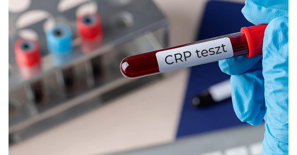 Gyulladásos markerek CRP és ESR a laborvizsgálatban