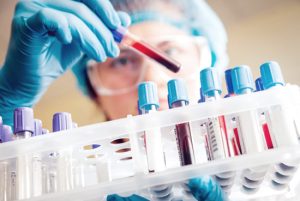 Labor rövidítések