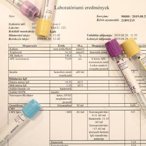 Laboratóriumi lelet papír alapon egy asztalon, rajta szemüveggel, a laboreredmények értelmezése témához.