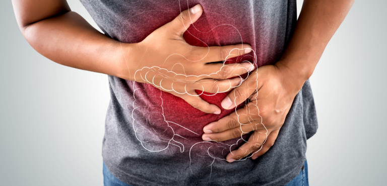 Vastagbélrák szűrés laborban, székletminta és tesztcsík